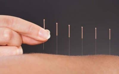 What is Medical Acupuncture, and How can it help?